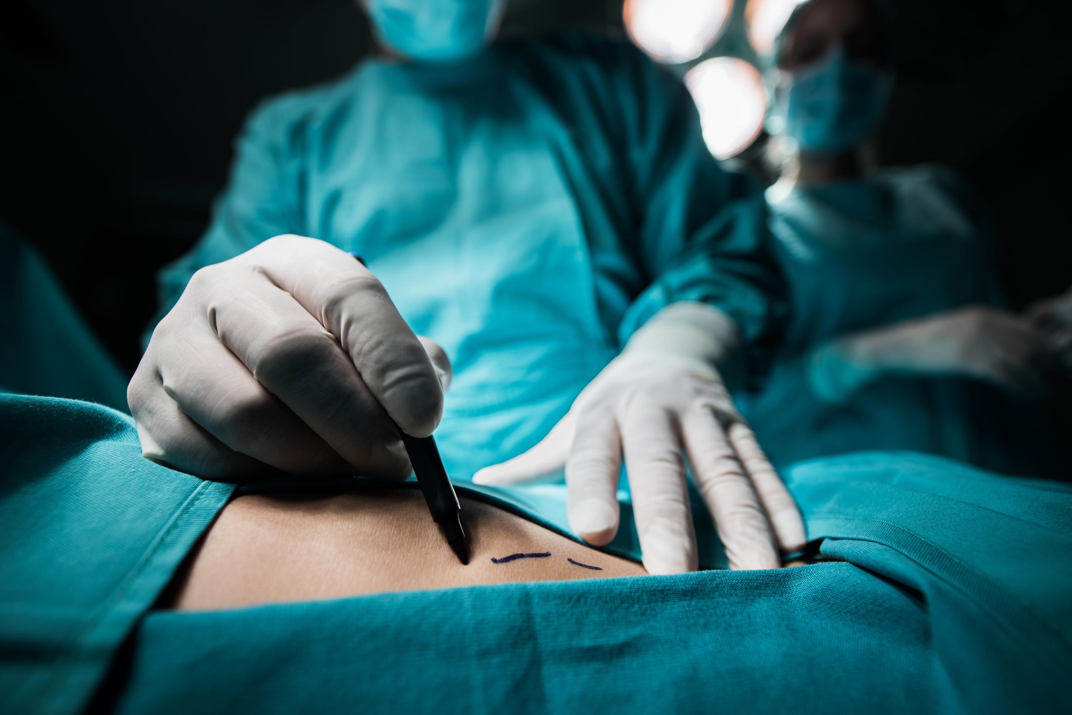 Close up of a doctor marking the human skin. A plastic surgeon marks a patient's skin prior to surgery.